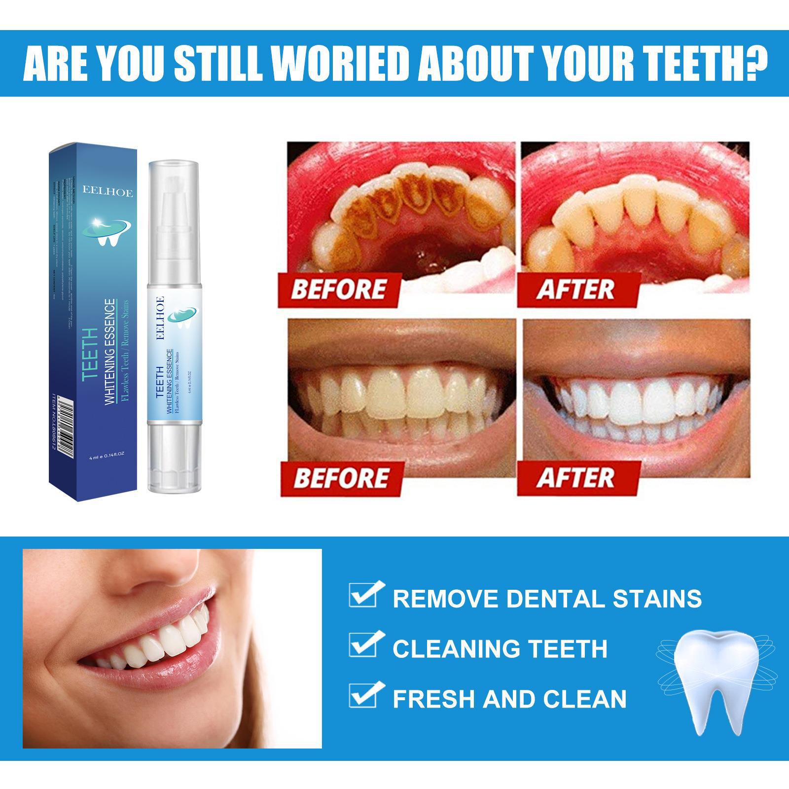Teeth Cleaning Pen Image 2
