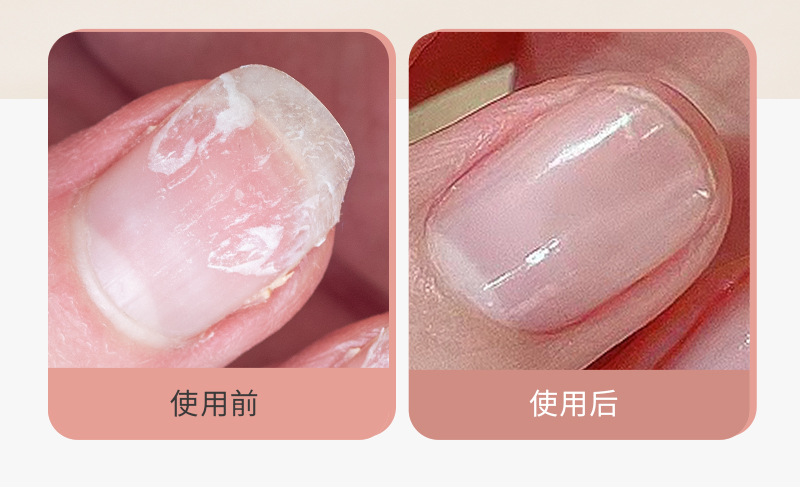 Heimat schräge Nagelschere Mädchen Rosa Set Edelstahl Ohrlöffel Nagelschere Augenbrauenschere Maniküre- und Pediküre-Werkzeuge