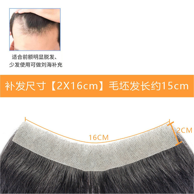 发际线假发贴假刘海假发片m形发际线贴男一片式前额补发自然真发|undefined