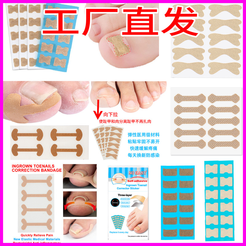Source factory glue-free self-adhesive nail paste nail groove nail inlay nail straightener toenail nail patch correction