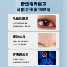 ������늺����ַ��o�ֺ��������Ԅ�׃�����o���^��ʽ늺��C��ñ