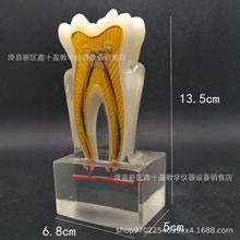 6倍牙神经解刨模型 牙齿剖面解析示范 神经线 牙釉质 髓腔 根管
