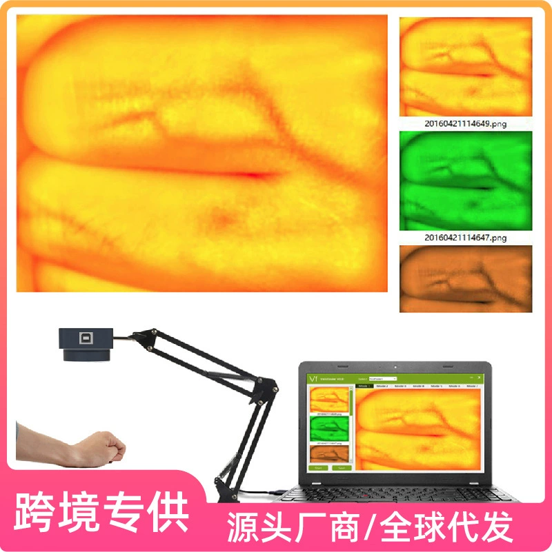 Устройство для поиска вен, визуализатор вен, прибор для пункции, экспортная модель