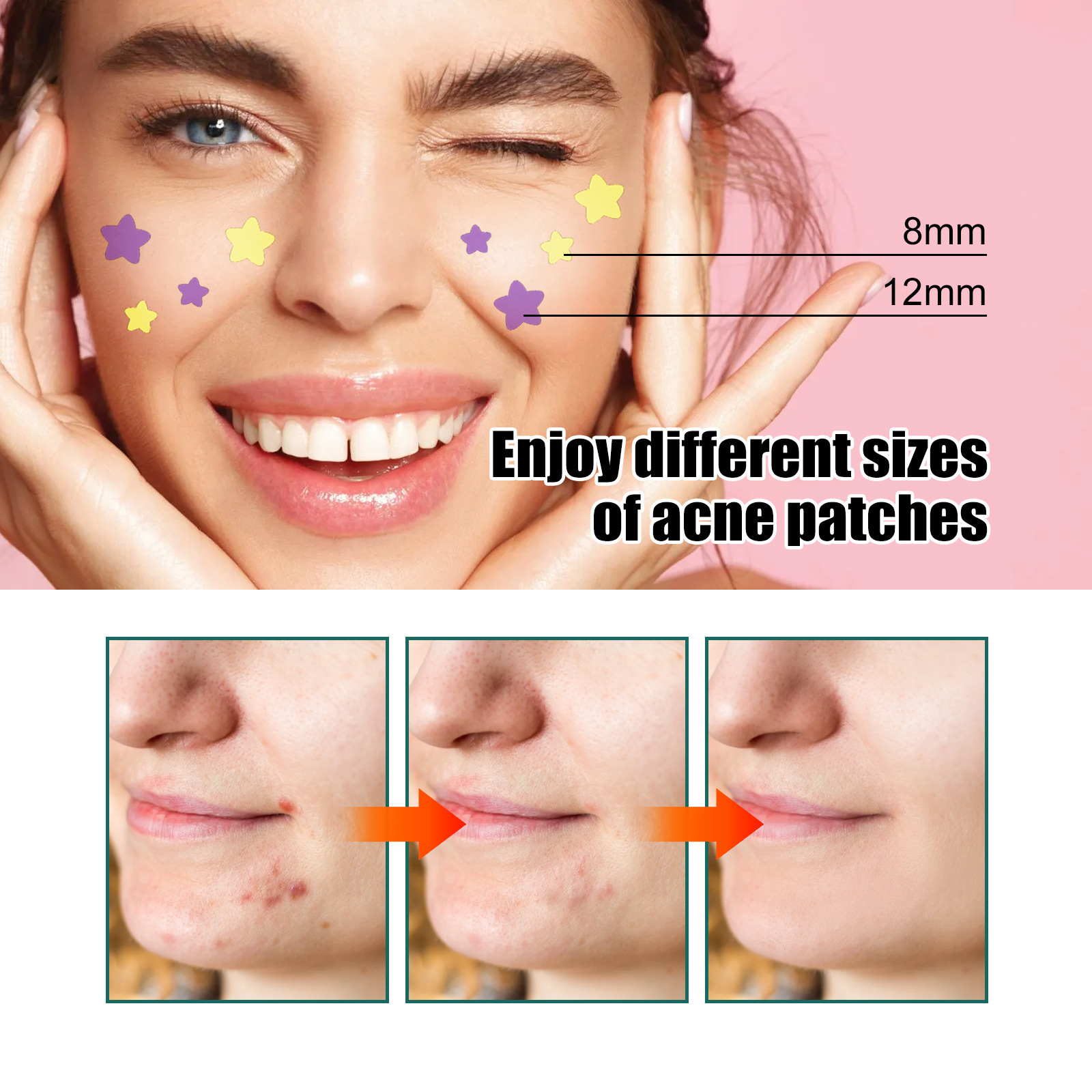 Star shaped patch for lightening spots, marks, cleaning, closing, covering, and repairing acne patches_voghion.com