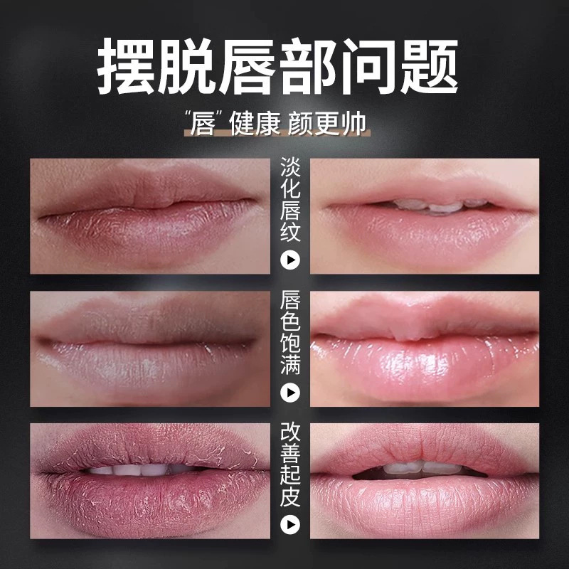 Su Xiuchen の昼夜の二重効果リップクリーム、保湿、保湿、秋冬の乾燥防止、べたつきのない男性用リップクリーム|undefined