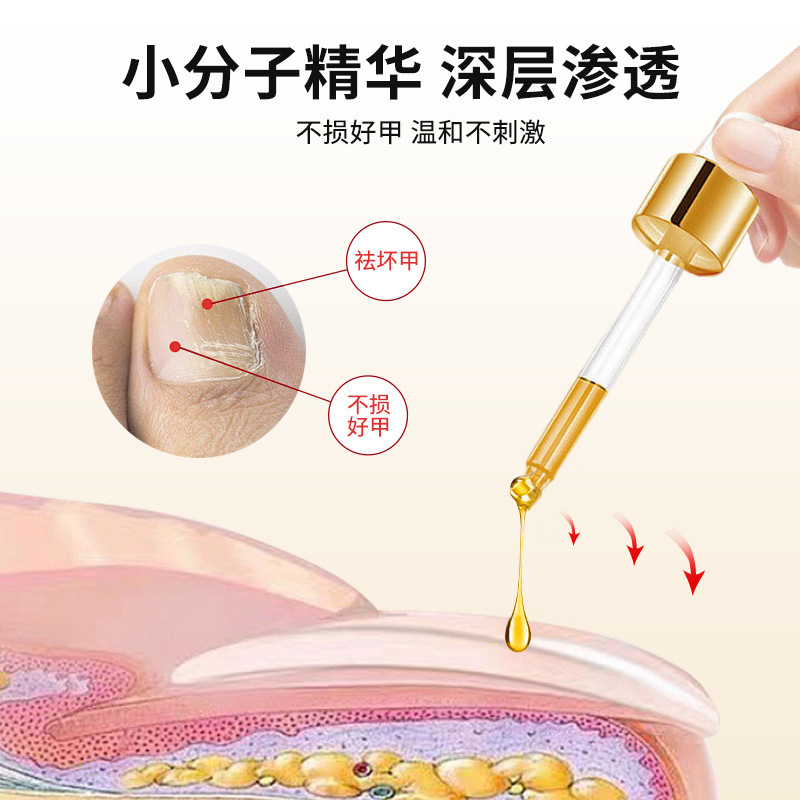 川弘宫廷盐酸阿莫罗芬搽剂正品灰指甲专用药阿罗莫芬搽剂工厂直营|undefined