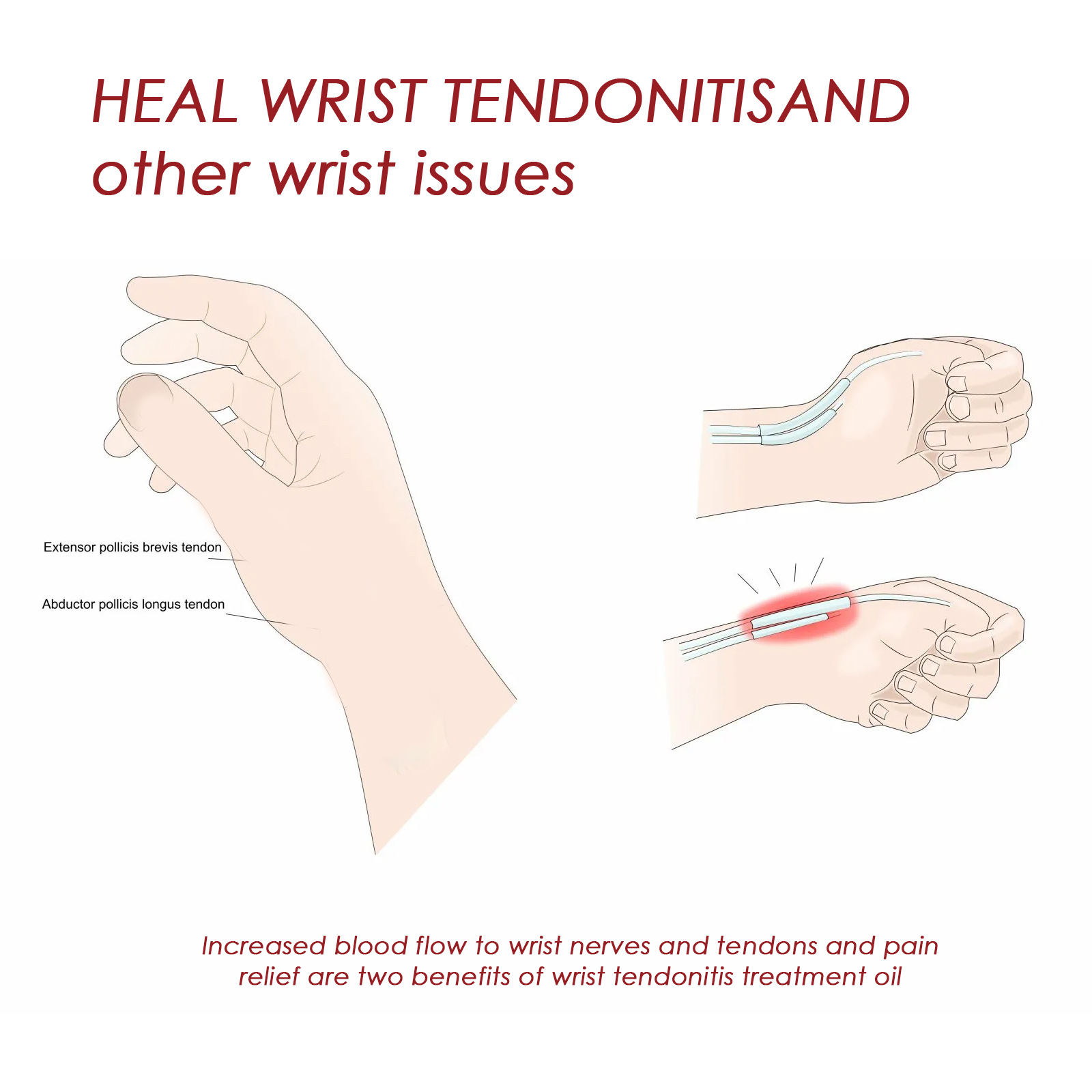 Mars Repair Körpermassagepflege, lindert Schmerzen im Handgelenk, ätherisches Öl_voghion.com