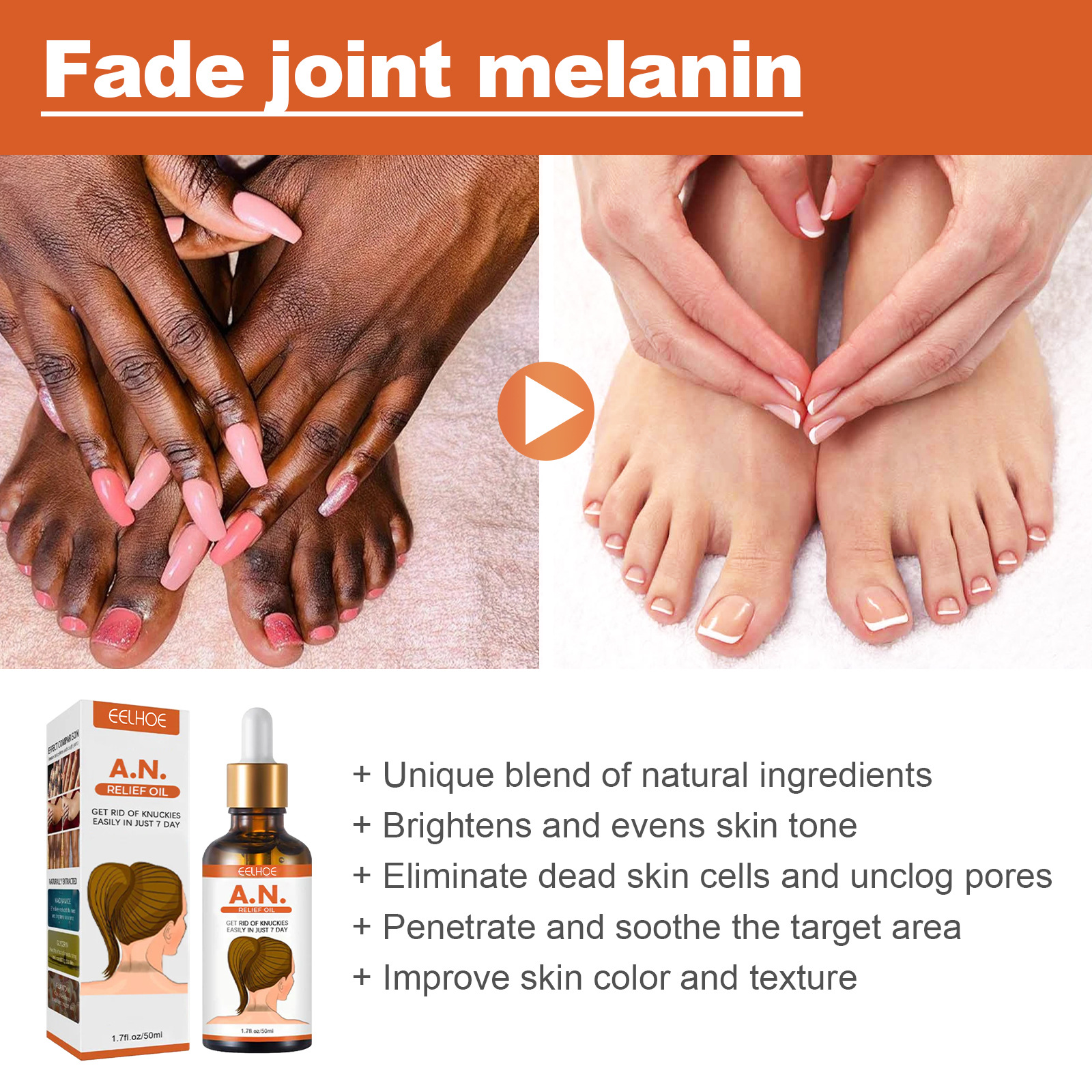 EELHOE Blackning&Whitning Essntial Oil Arm Axillary Joint Moisturizing&Brightning Evn Skin Color Exfoliating_voghion.com