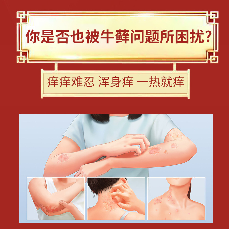 香港牛苔王軟膏 頭皮・太もも・銀皮症専用正規品を工場直販|undefined