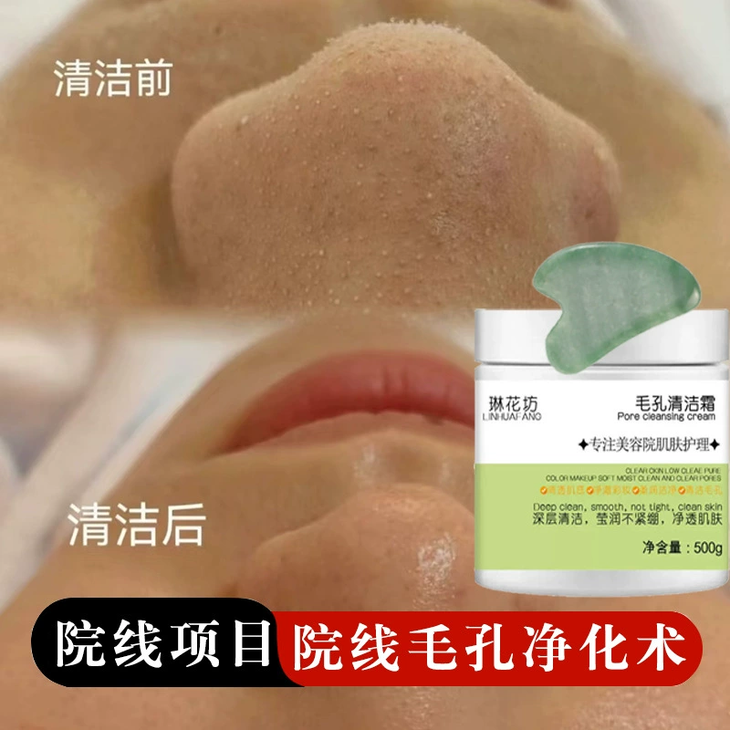 Специальный крем для чистки пор для салона красоты для удаления угрей