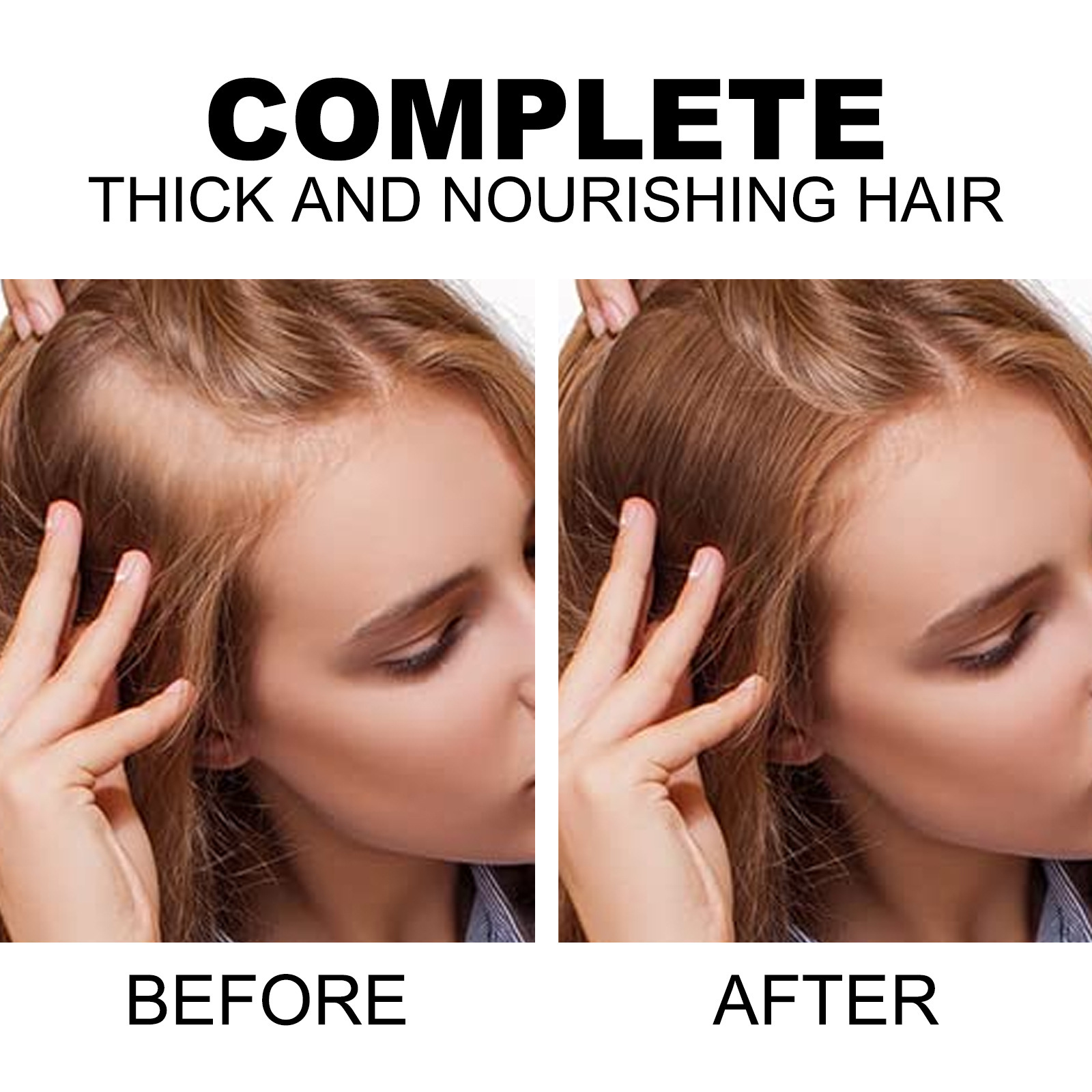 HOEGOA 大米水密發噴霧頭髮深層滋養防掉堅韌固發密發頭皮護理液