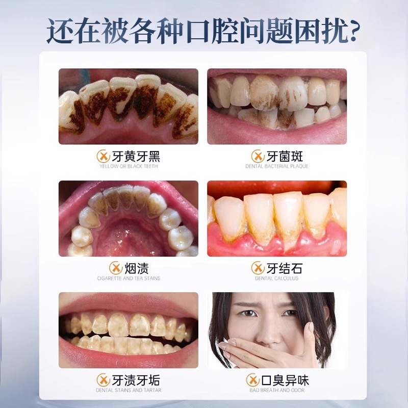 白云山牙膏美白修护牙釉质去口臭去烟渍去黄牙膏成人牙膏|undefined