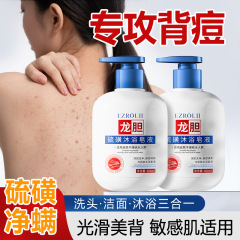 Yizilu ヘビ胆汁硫黄シャワージェルは、肌のかゆみ、背中、ニキビ、赤い点を改善します。男性と女性向けの硫黄液体石鹸です。