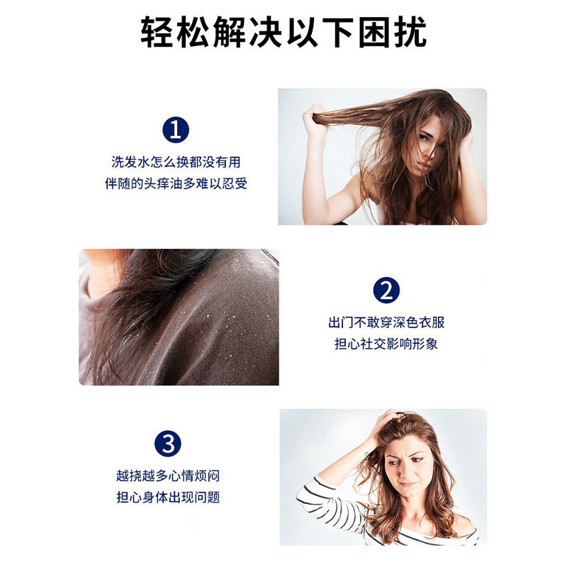 Zou Runan Chikang Wang Ketoconazole シャンプー、抗菌ローション、毛包洗浄、頭皮油ダニ、フケ、頭皮苔、さわやか|undefined