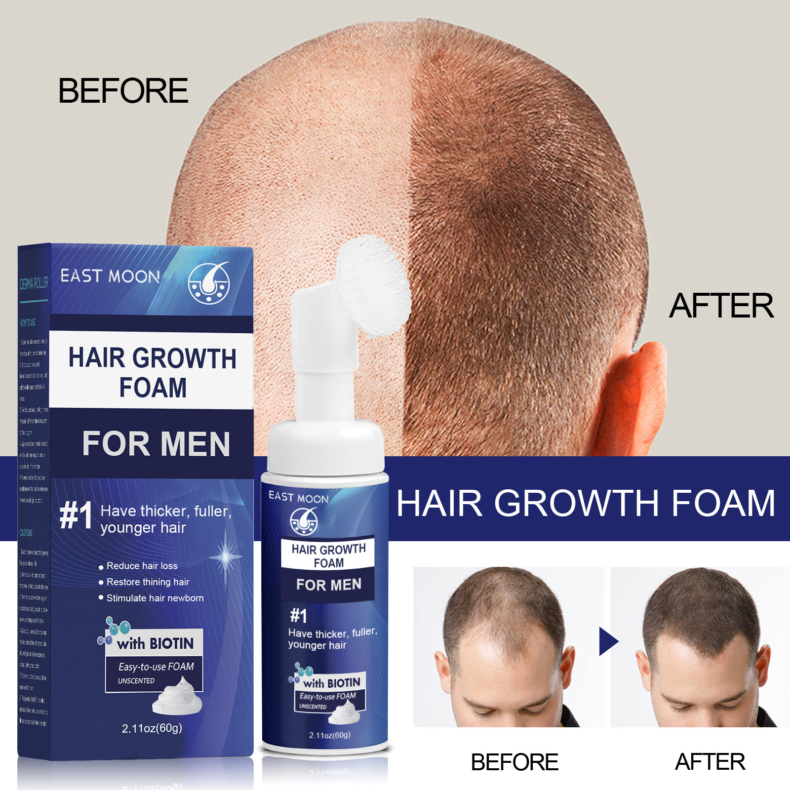Schaum East Moon Men's Dense Moisturizing Care Tiefenreparierende Haarwurzelfollikel_voghion.com