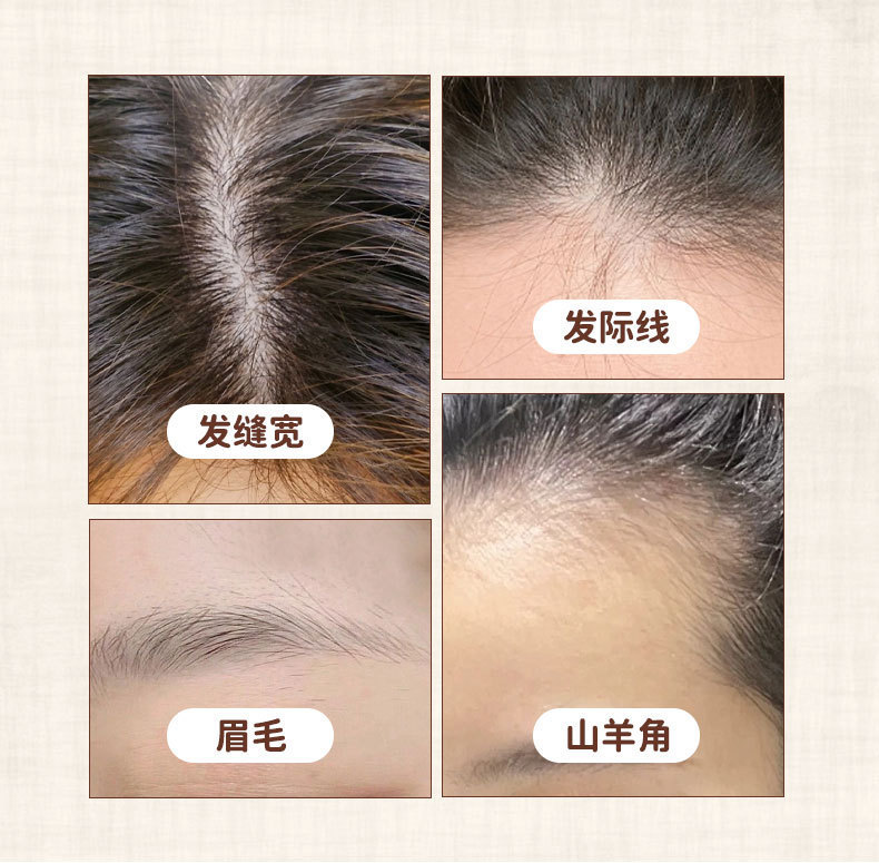 Platycladus Leaf and He Shou Wu Scalp Care Liquid Herbal Hair and Scalp Tonic 10ml overview
