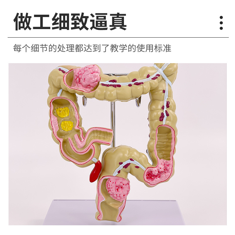 ��ѧ��������󳦲���ģ�ͳ�θֱ���̴�������ʳ��������᳦����