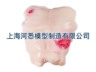 穿戴式血气胸穿刺训练模型
