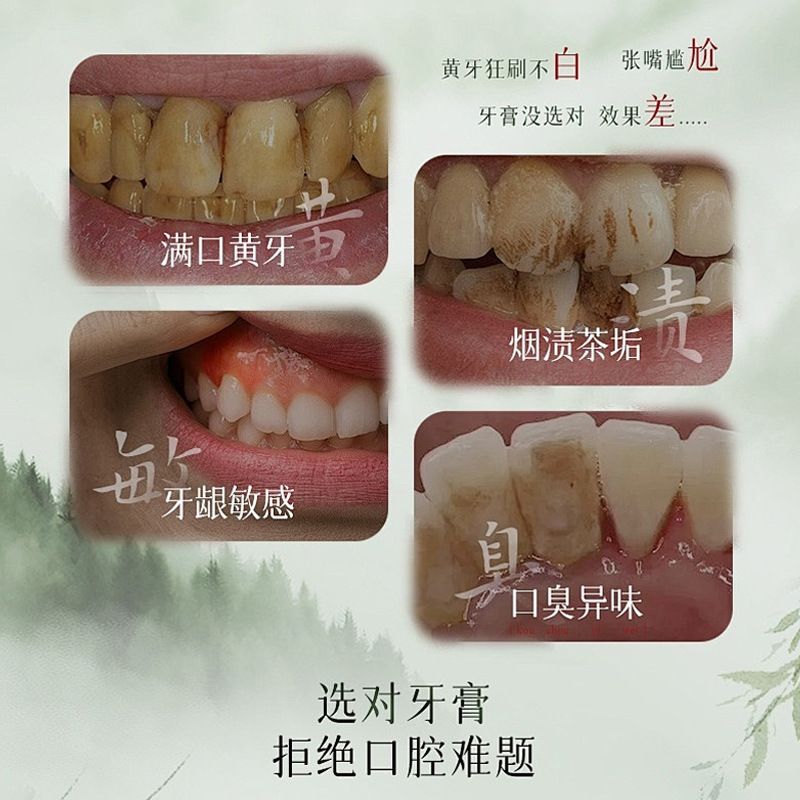 Extracto de hierba Auonam Aonan polvo de dientes, aliento fresco, cuidado de dientes blancos brillantes, eliminación de manchas de dientes, fabricante de olor