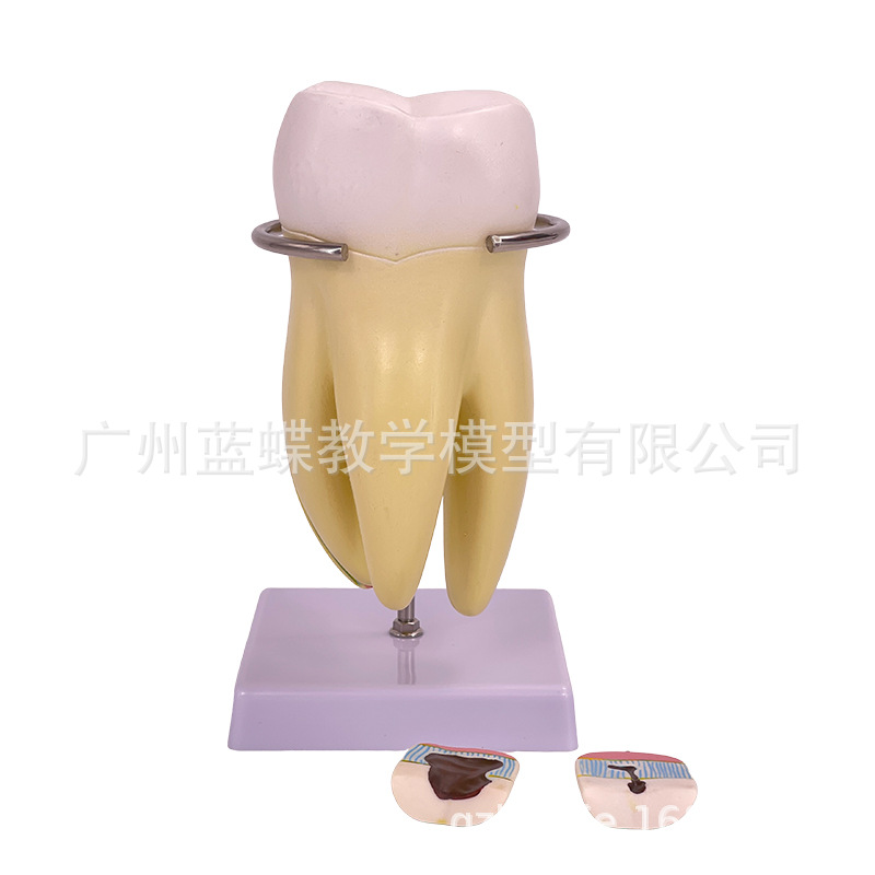 ���ƿ�ǻ�ı�ȣ�ݷֽ�ģ�� ����������ʾȣ�ݷ�չ���� ҽ����ͨ