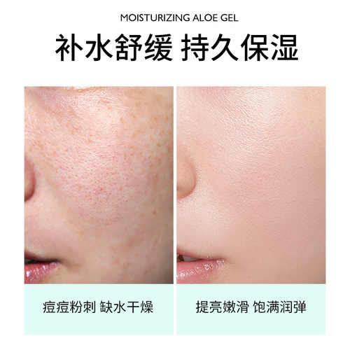 Aloe vera gel wholesale hydrating moisturizing cream after sun care aloe vera gel 300g skin care products wholesale