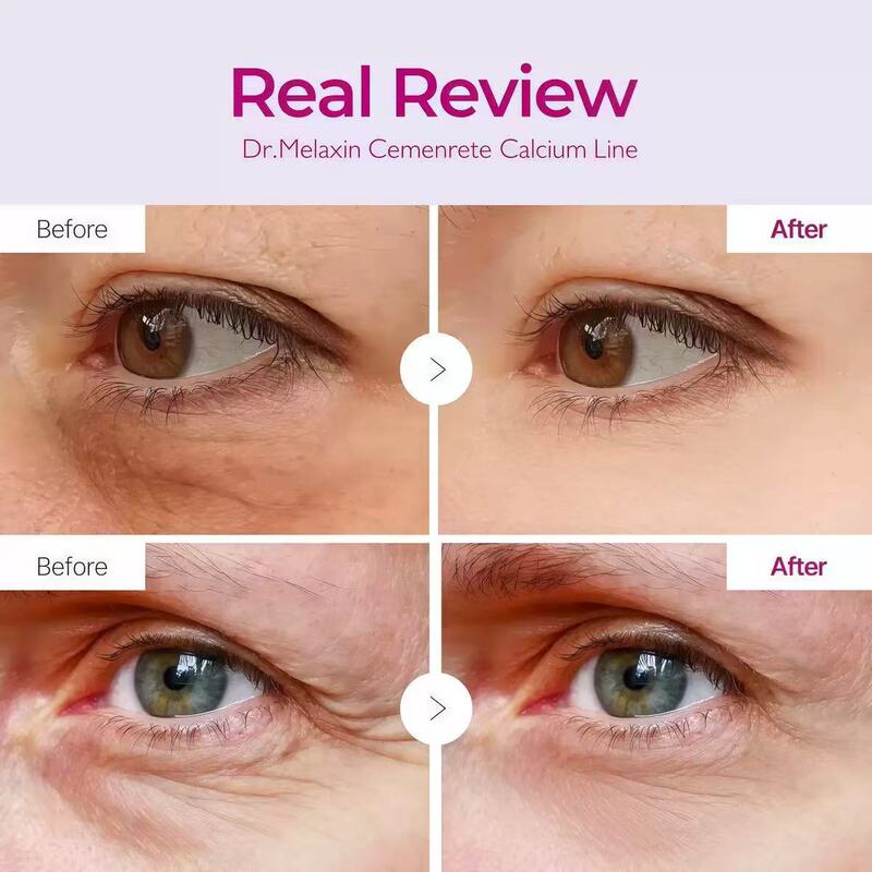 跨境爆款Cemenrete Calcium Multi Balm眼霜棒抗皱紧致淡化黑眼圈|undefined