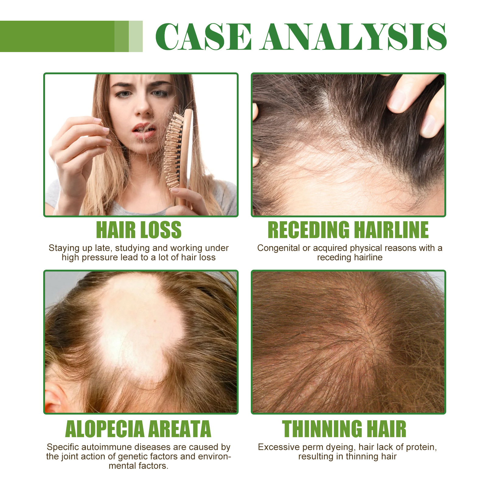 Répare les cheveux secs et endommagés du mois, hydrate les cheveux épais et denses, prévient la perte et fixe l'huile d'essence des cheveux_voghion.com