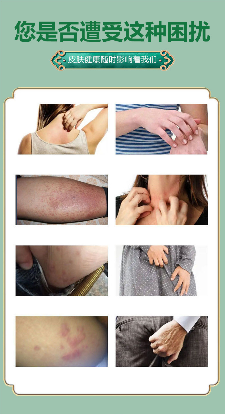 Shennong Baiyang Wang Herbal Ointment 20g External Topical Balm for Traditional Herbal Care quality and texture