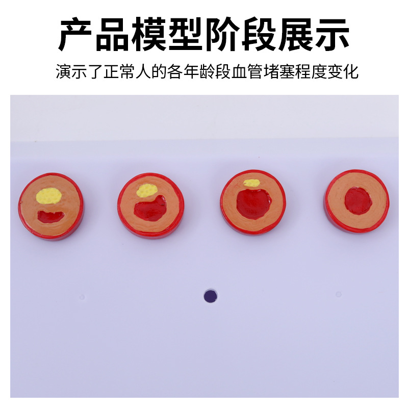 Ѫ��/���� ѪҺŨ��֬�� ����ѪҺ Ѫ������/Ѫ�ܲ������� ģ��