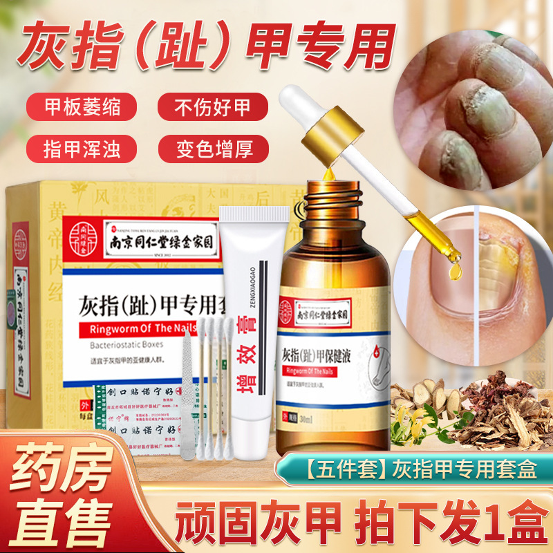 Onychomycosis Care and Health Care Solution Special Set Soft Nail Cream Manufacturer Wholesale Dropshipping