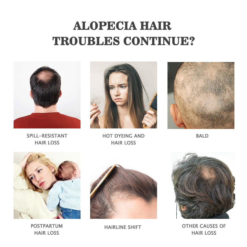 Hair care essential oil anti split plant extract for repairing restlessness 30ml_voghion.com