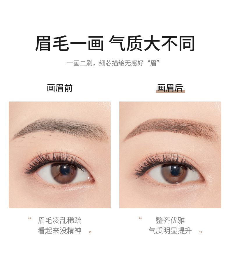 详情