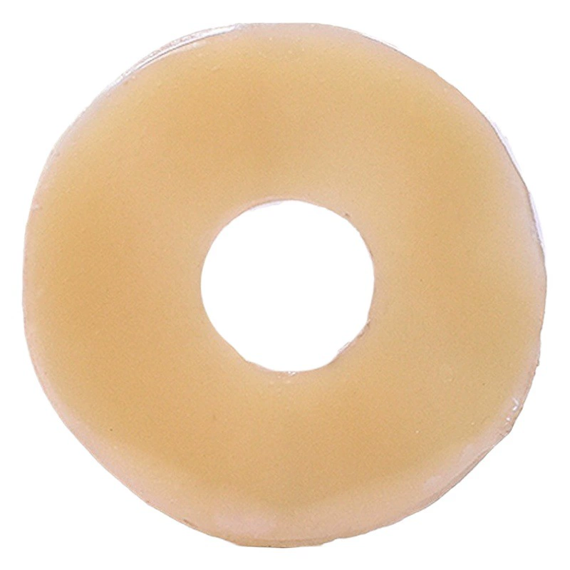 Карманное герметичное кольцо, пластиковое кольцо для патчей, шасси из керамики, герметичное кольцо для патчей, аксессуары для средств по уходу за стомой, трансграничное Nianqing