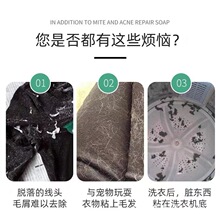 �LͲϴ�C�Vë���^�V�W����Ư������ϴ�o��ȥ��ëճë������ë��