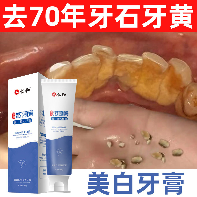 歯磨き粉本物の仁和酵素プロバイオティックリゾチームフレッシュブレス卸売茶煙汚れ歯磨き粉除去黄ばみと口臭|undefined