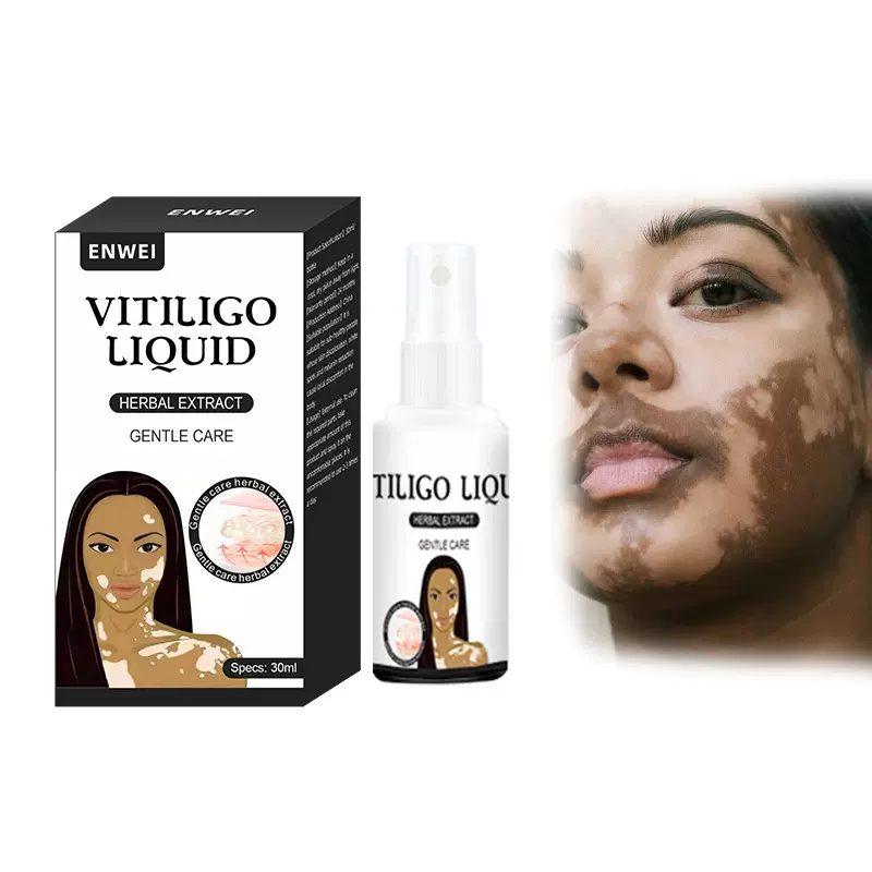 亚马逊跨境药膏白斑膏汗斑花斑护理vitiligo spray批发