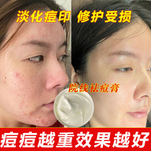 ����Ժ���ȥ�۴��]�ڵ�����ӡ�����ഺ��������Ůͨ�����˪