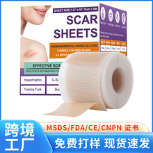 �̺���Silicone Sca Sheets1.5m�����滺�˰�Ƥ���轺�̺���