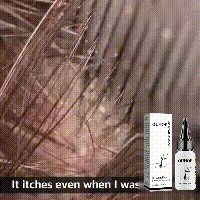 OUHOE Growth Kräuteressenz Feuchtigkeitsspendende, straffende, dichte Haarpflege_voghion.com