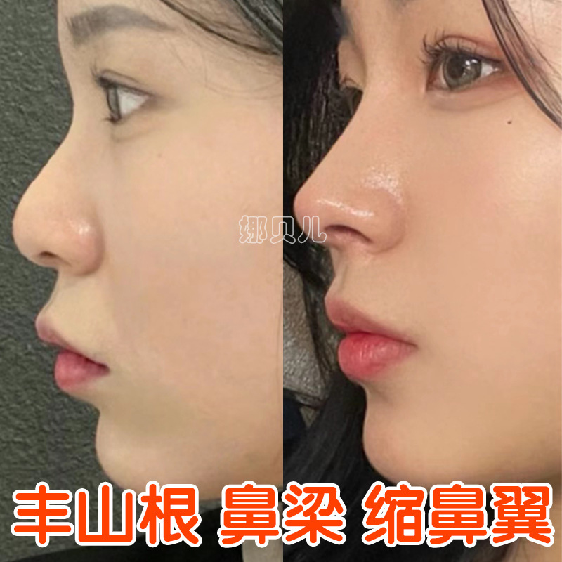 美鼻精油やせた鼻の神器は山根の高い鼻筋の顔の精華をまっすぐに抜いて鼻翼を縮小して高くなって液を伸ばして鼻の精油を伸ばします。|undefined