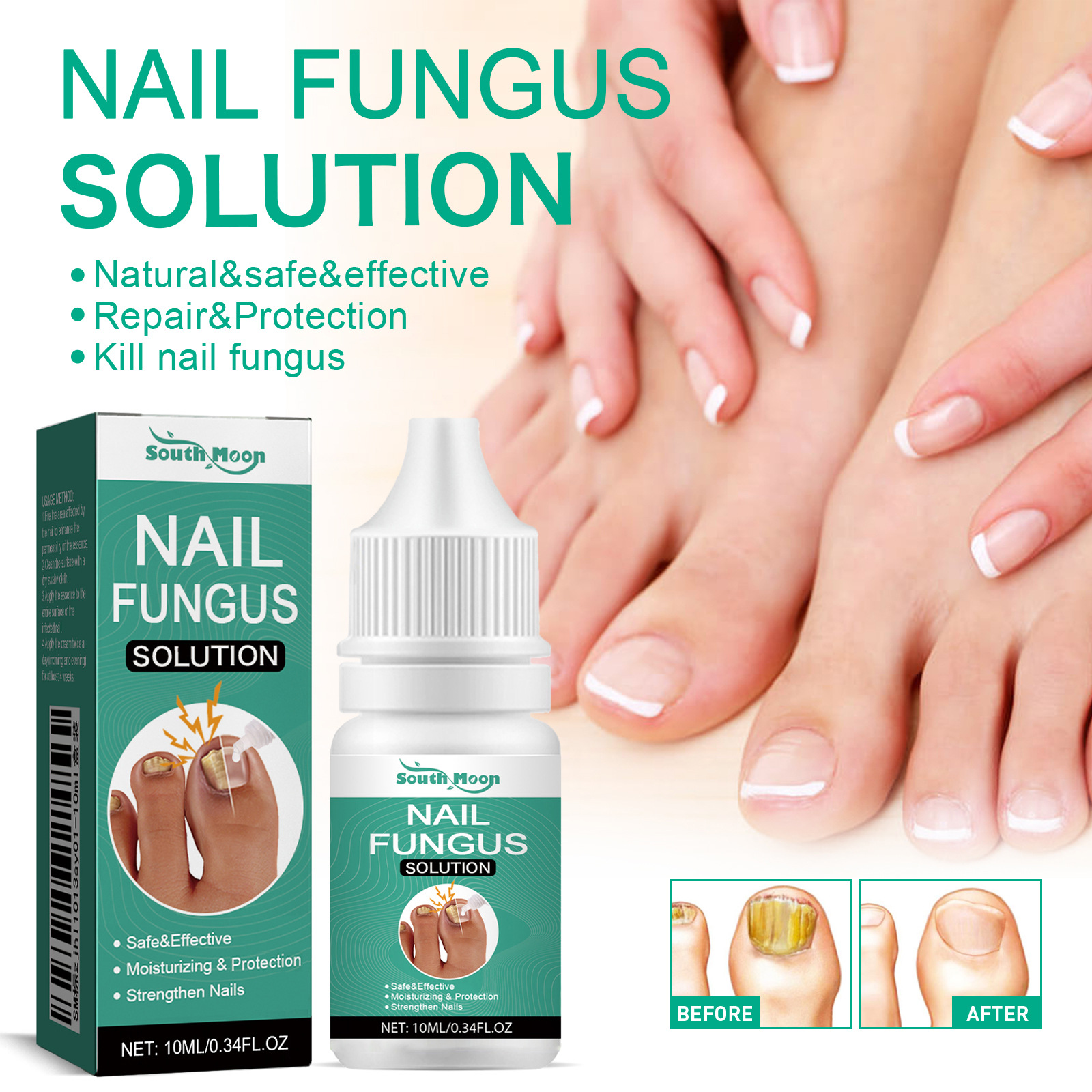 South Moon Nail Care Essence, Toenail Thickening, Yellowing, Ingrown Nail Treatment, Fungus Nail Shining and Repair
