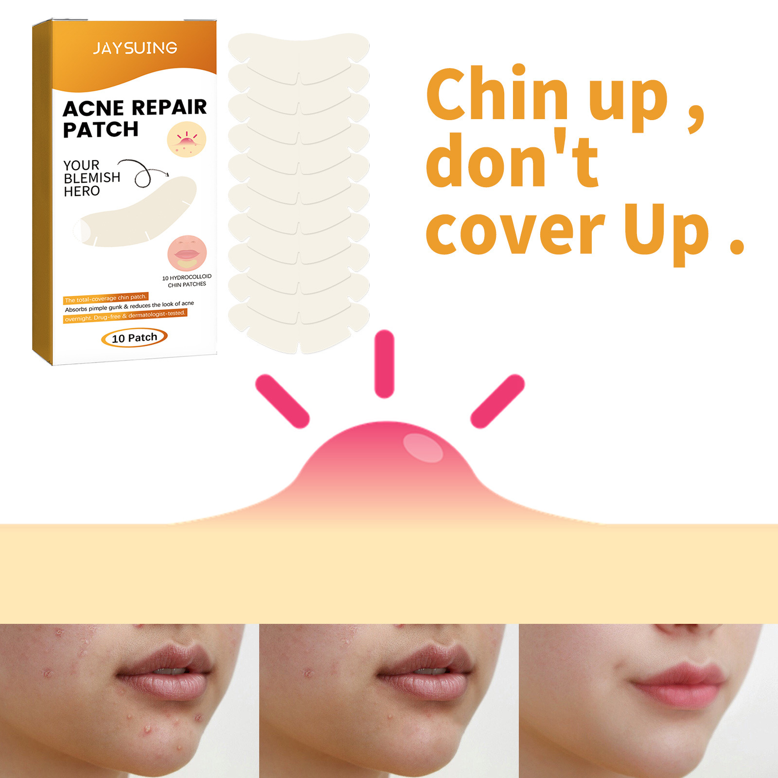 Jaysuing Chin Gel Cleaning Patch Φορητό αφαίρεση και εκτύπωση ακμής_voghion.com
