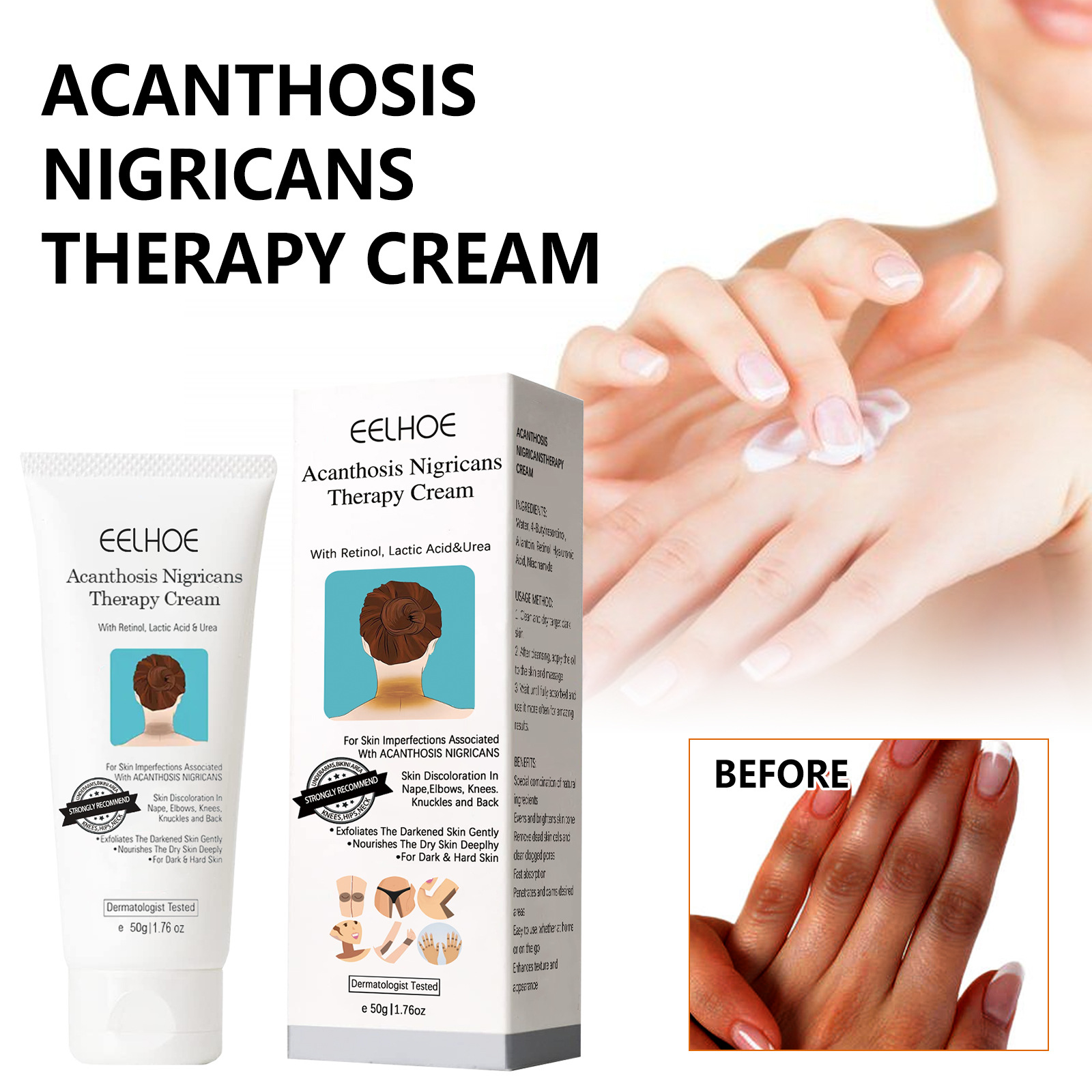 EELHOE Thorny Skin Repair Moisturizes, Brightens, Repairs Underarm, Knee Joint, and Black Body Care Cream_voghion.com