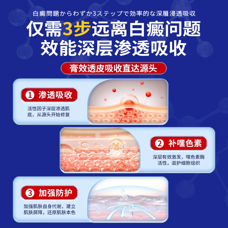 岩京紅、ソラレン、ソラレン、白斑軟膏、白斑、白斑外用軟膏、メラニンの成長促進、工場直販|undefined