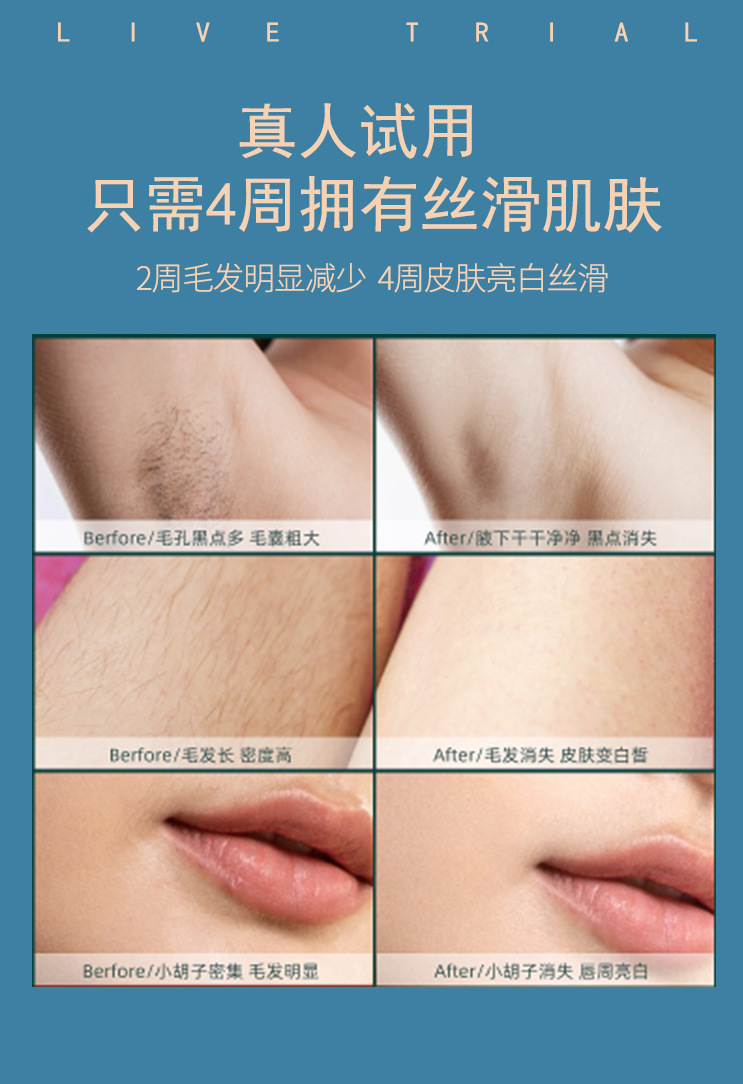 脱毛仪详情页_08