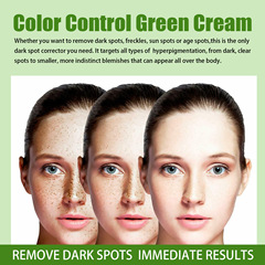 Jaysuing Pigment Control and Lightening Spot Green Cream, Spot Pigment Decomposition Revitalizing Brightening, Spot and Mole Lightening, followed by Pigment Control Green Cream