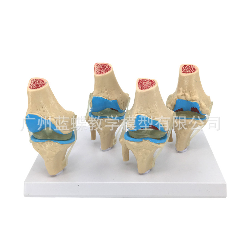 ���岡��ϥ�ؽ�ģ�� ��̬ϥ�ؽ������� ϥ�ؽ� ϥ�ؽھ�������ͨ