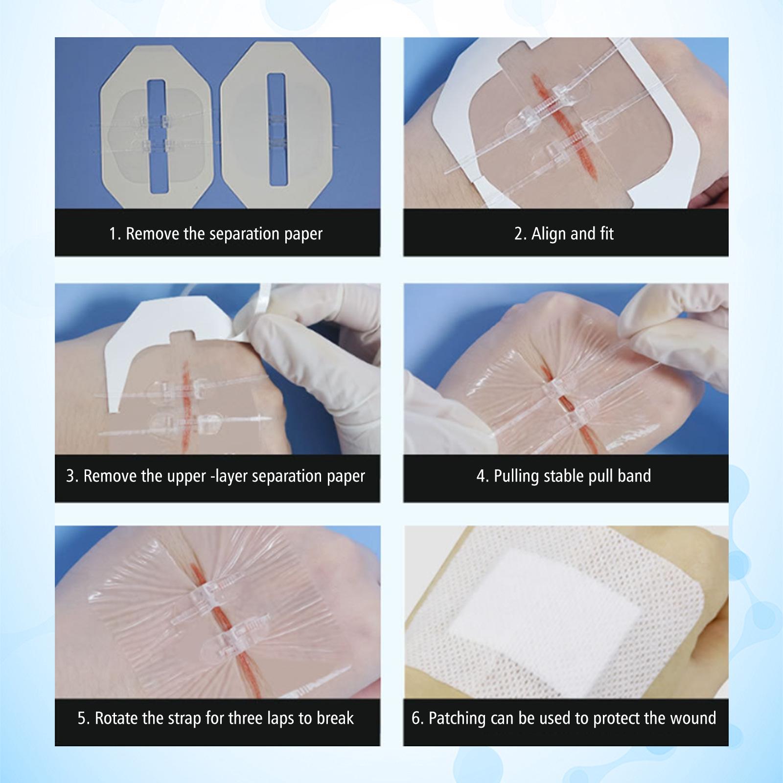 South Moon suturfrit lukkeplaster, suturfrit plaster, hudsårplejeplaster_voghion.com