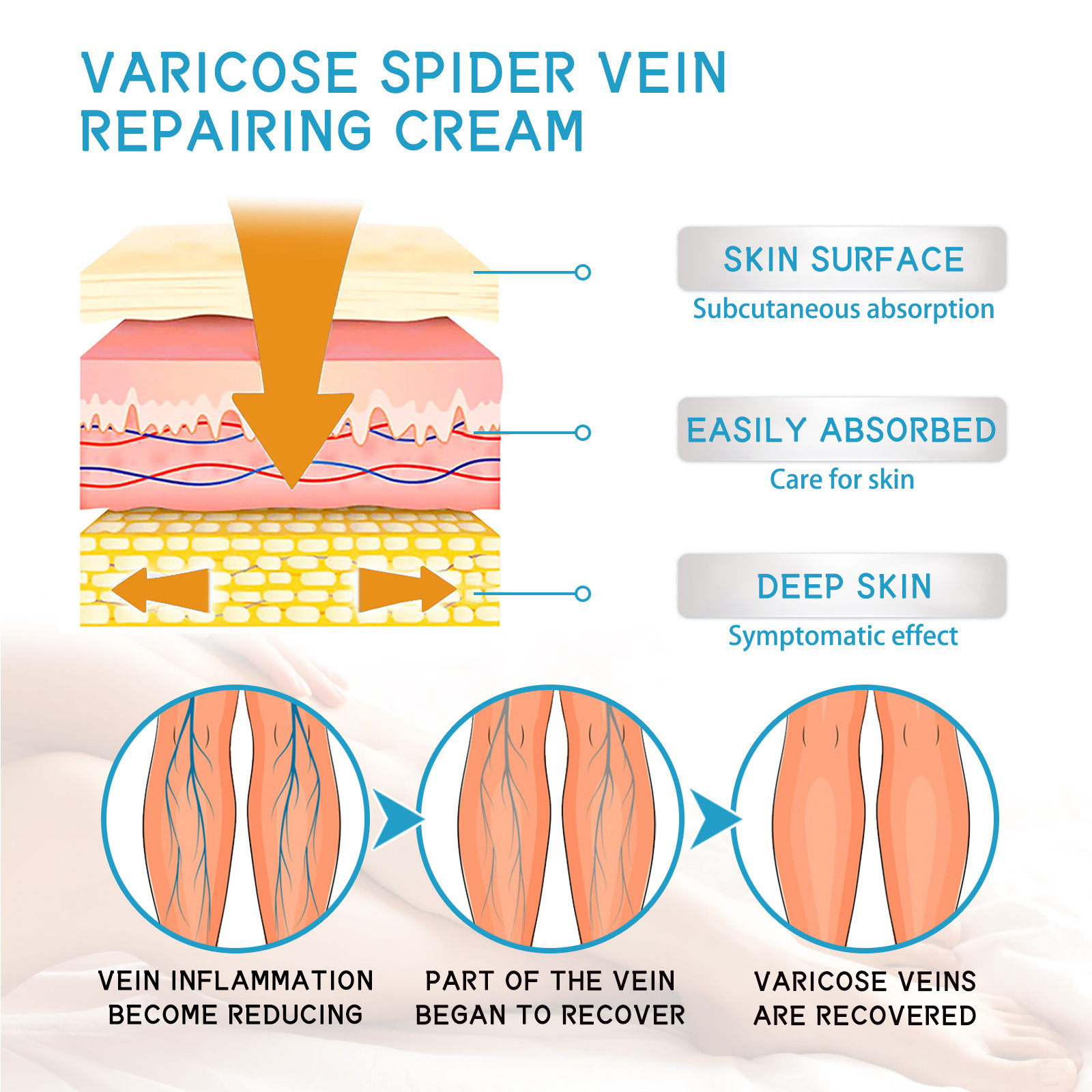 Lindert West&Month Repair Pain Regenwurm Bein prall gefüllte Venenpflege-Massagecreme_voghion.com
