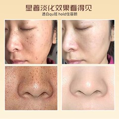 Beauty Salon High-Efficiency Melasma Control Cream Laser Postoperative Melanin Backflow Control Cream Freckle and Hyperpigmentation Whitening Spot Removal Cream